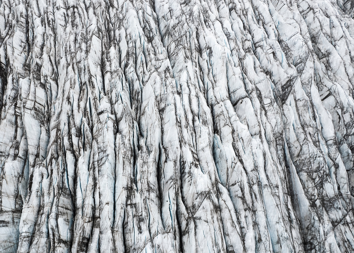 Fractures
