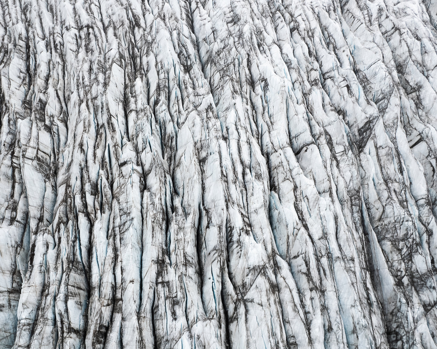 Fractures